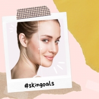 Your Journey to Clear Skin Starts & Stops with OZiDEX ðŸœðŸ‘€