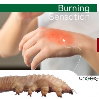Burning Sensation