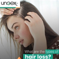 Hair Loss Vs Demodex Mites!