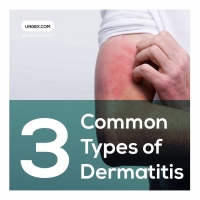 Three Common Types of Dermatitis