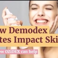 How Demodex Mites Impact Skin And how Ozidex can help