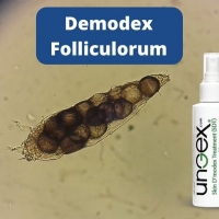Demodex Folliculorum