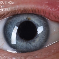 How Do You Know if You Have Eyelash Mites?
