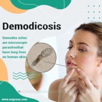 Demodicosis â€‹