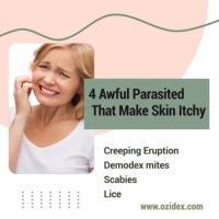 4 Awful Parasite that makes skin itchy